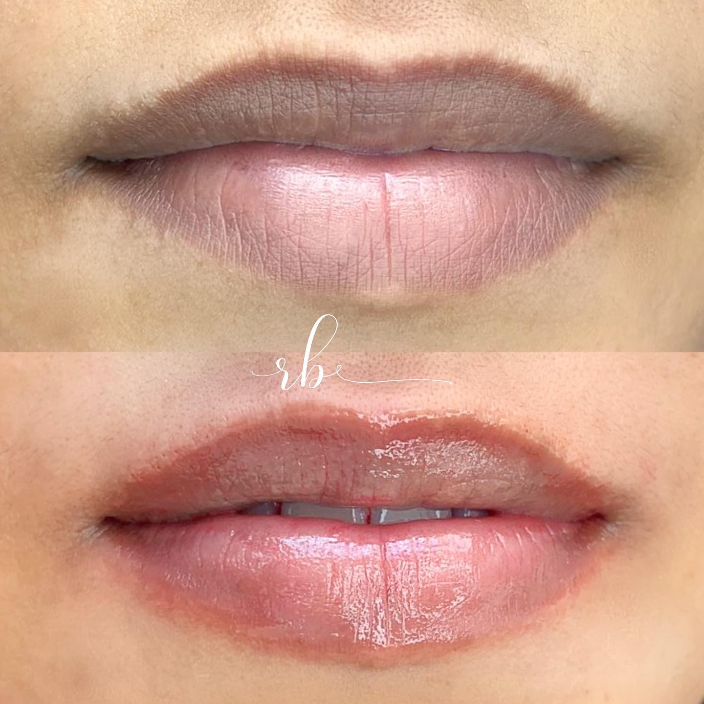 Resultado de Nutri Lips na Rosa Beauty Space